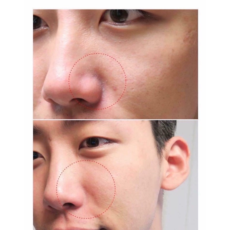 Thanh lăn mụn đầu đen Mamonde Pore Clean Blackhead Stick, THANH LĂN MỤN ĐẦU ĐEN MAMONDE MẪU MỚI NHẤT 2018