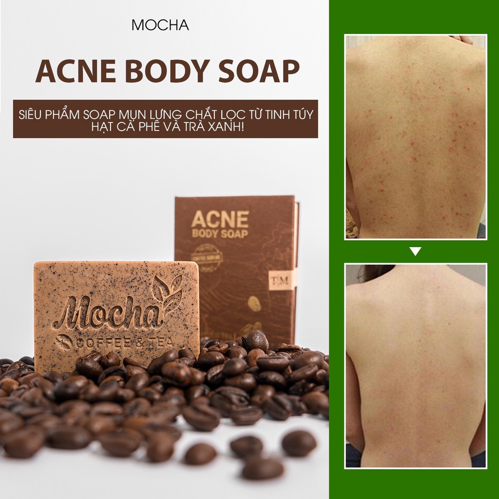 Xà Phòng Giảm Mụn Lưng Mocha Acne Body Soap, Đánh Bay Mụn Lưng, Láng Mịn Làn Da