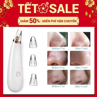 Máy hút mụn black head - làm sạch mụn cám hoặc mụn đầu đen