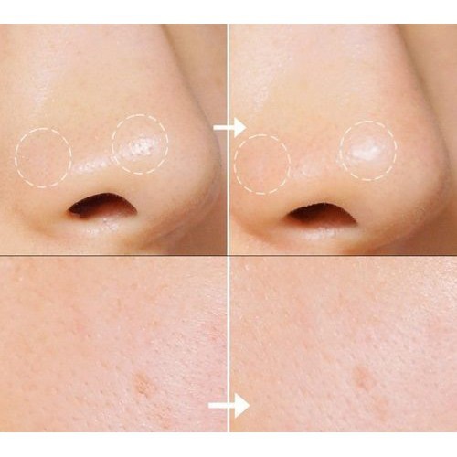 Toner hoa cúc kiehl’s calendula mini 40ml | BigBuy360 - bigbuy360.vn