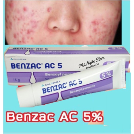 Kem Trl M.ụ.n Benzac Ac 5% Galderma Tuýp 15g