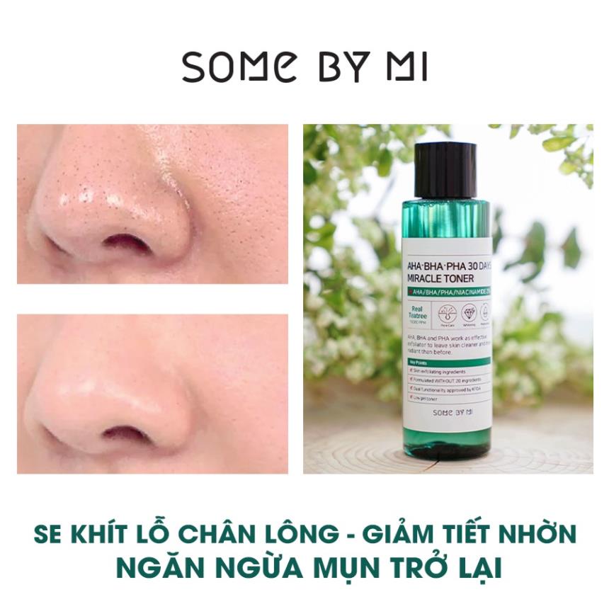 Hàng Công ty  Nước Hoa Hồng Giảm Mụn Some By Mi AHA-BHA-PHA 30 Days Miracle Toner 150ml