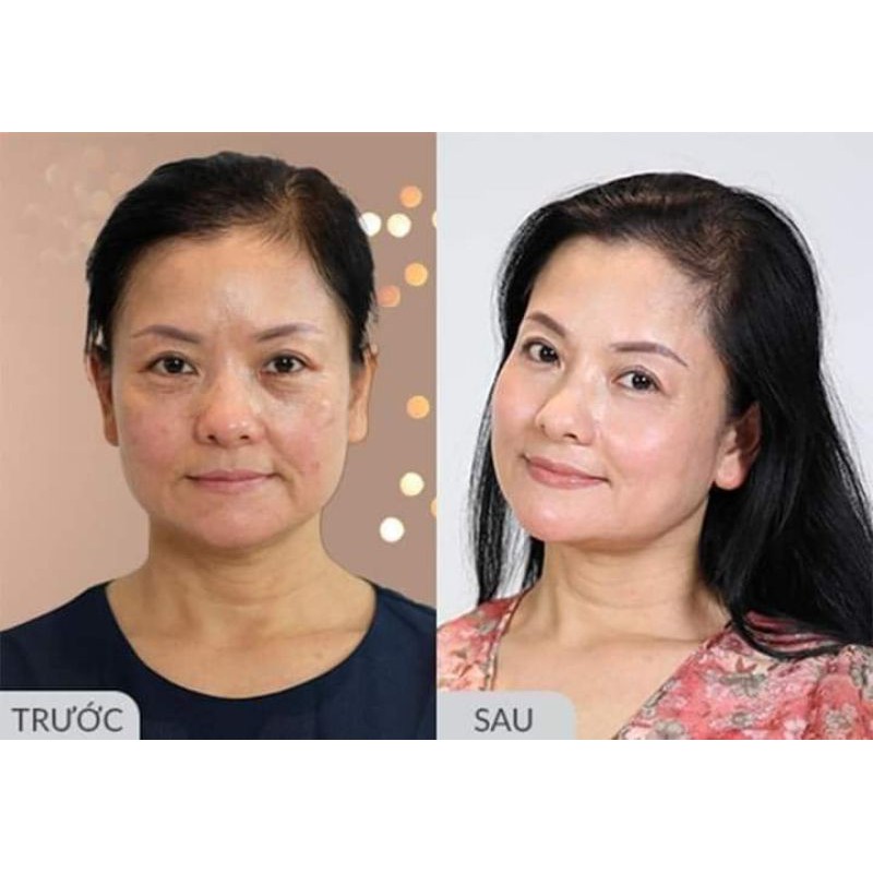Combo Kem Dưỡng Face Collagen Sữa Non Và Ủ Dưỡng Trắng Hút Nám Thải Chì Femmiu - Hiệu quả rõ sau 7 ngày
