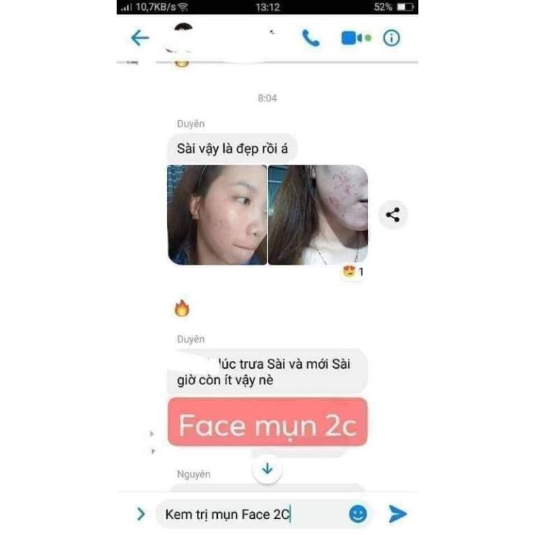 KEM FACE MỤN TRẮNG DA 2C