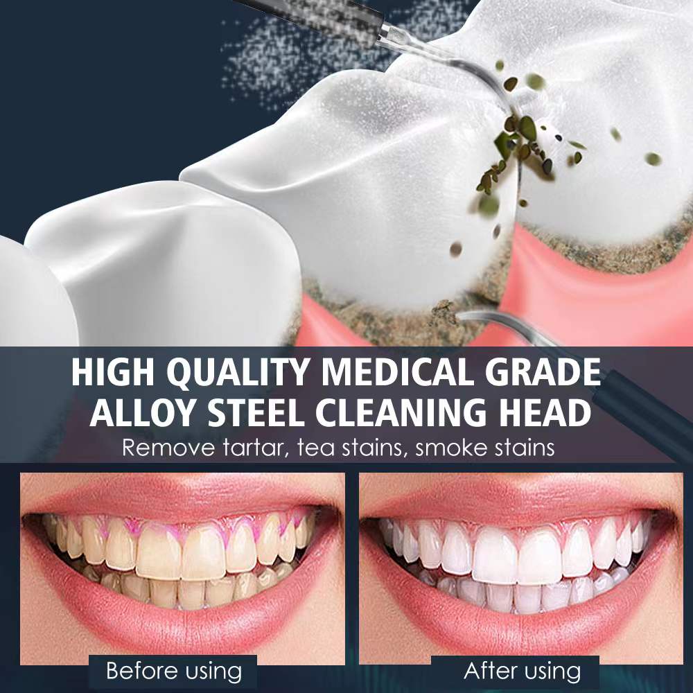 Bàn chải điện tự động đánh răng, tăm nước điện làm sạch đá răng, 3 chế độ cao cấp