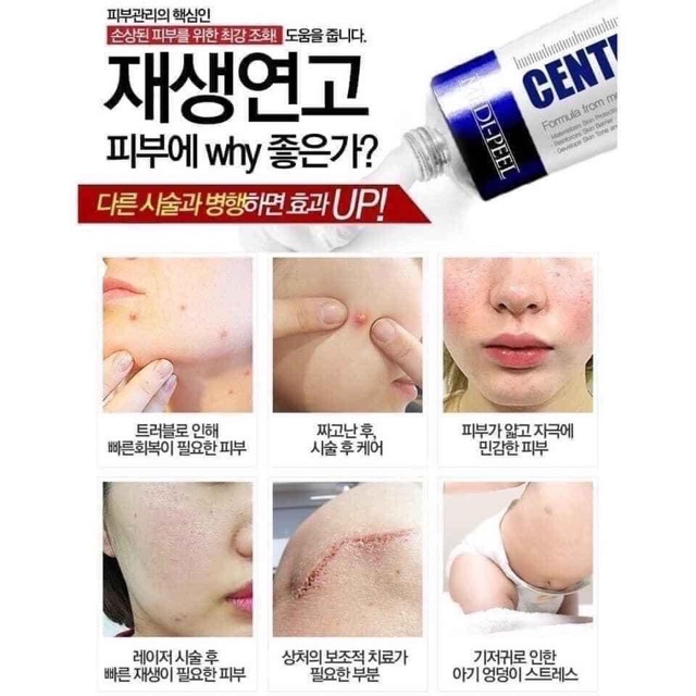 Kem Rau Má Giảm Mụn Phục Hồi Da MediPeel Centella Mezzo Cream | BigBuy360 - bigbuy360.vn