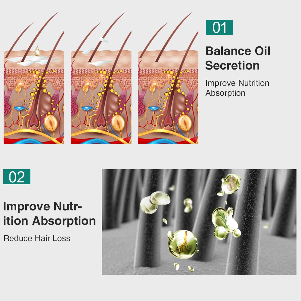 Serum Kích Thích Mọc Tóc Agdoad Chiết Xuất Gừng Tự Nhiên Ngăn Rụng Tóc Chống Rụng