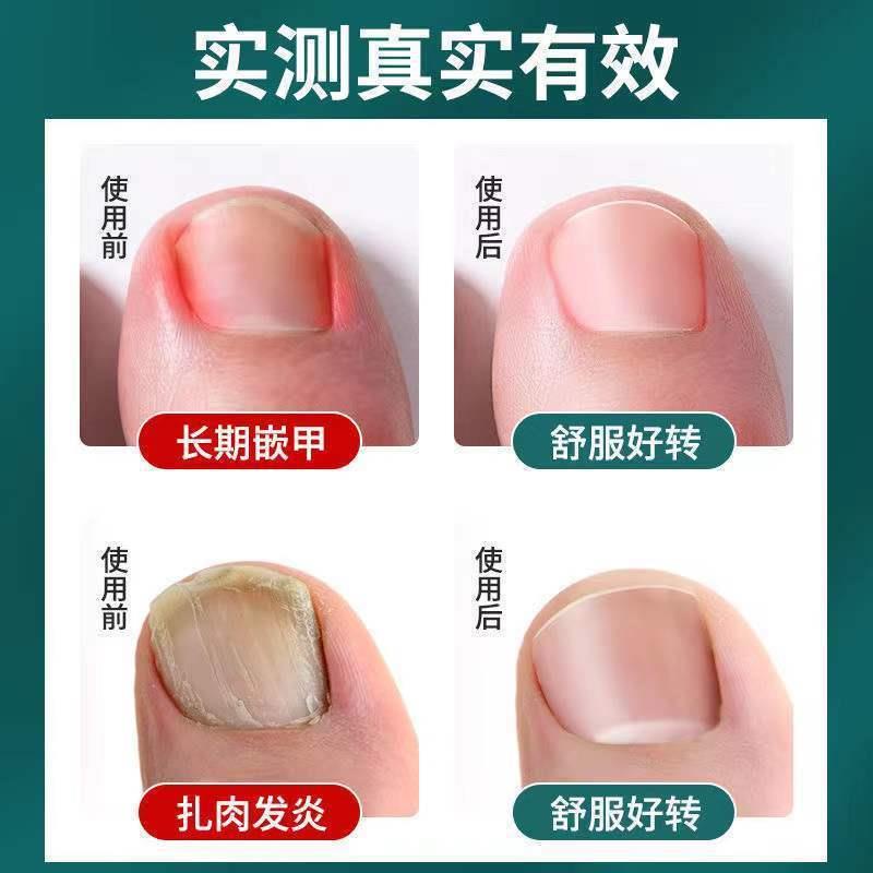 Z Bộ Kềm Cắt Móng Tay / Móng Chân Bằng Thép Không Gỉ