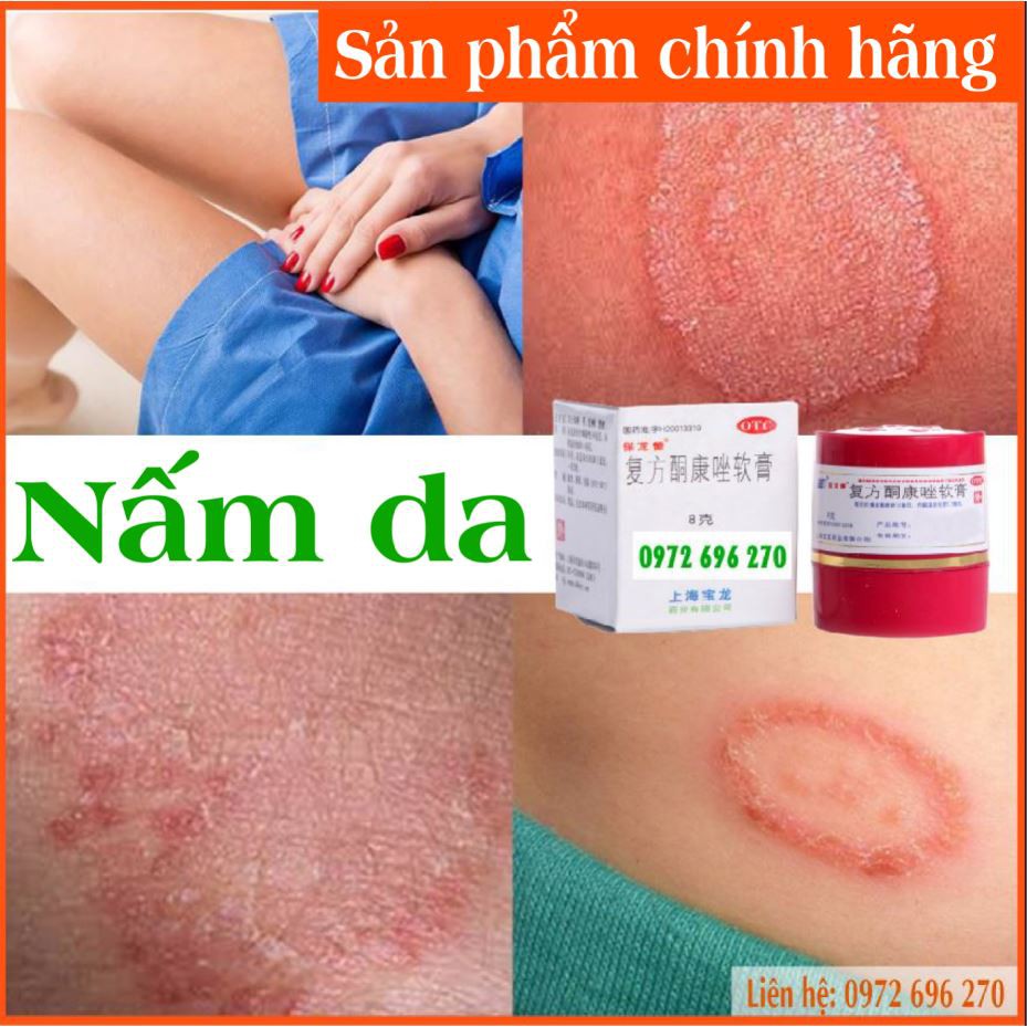 KEM BÔI ĐÔNG Y [ Cực hiệu quả ]