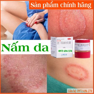 KEM BÔI NẤM DA HÁNG BẸN [BẢO LONG KHANG ] CỰC HIỆU QUẢ