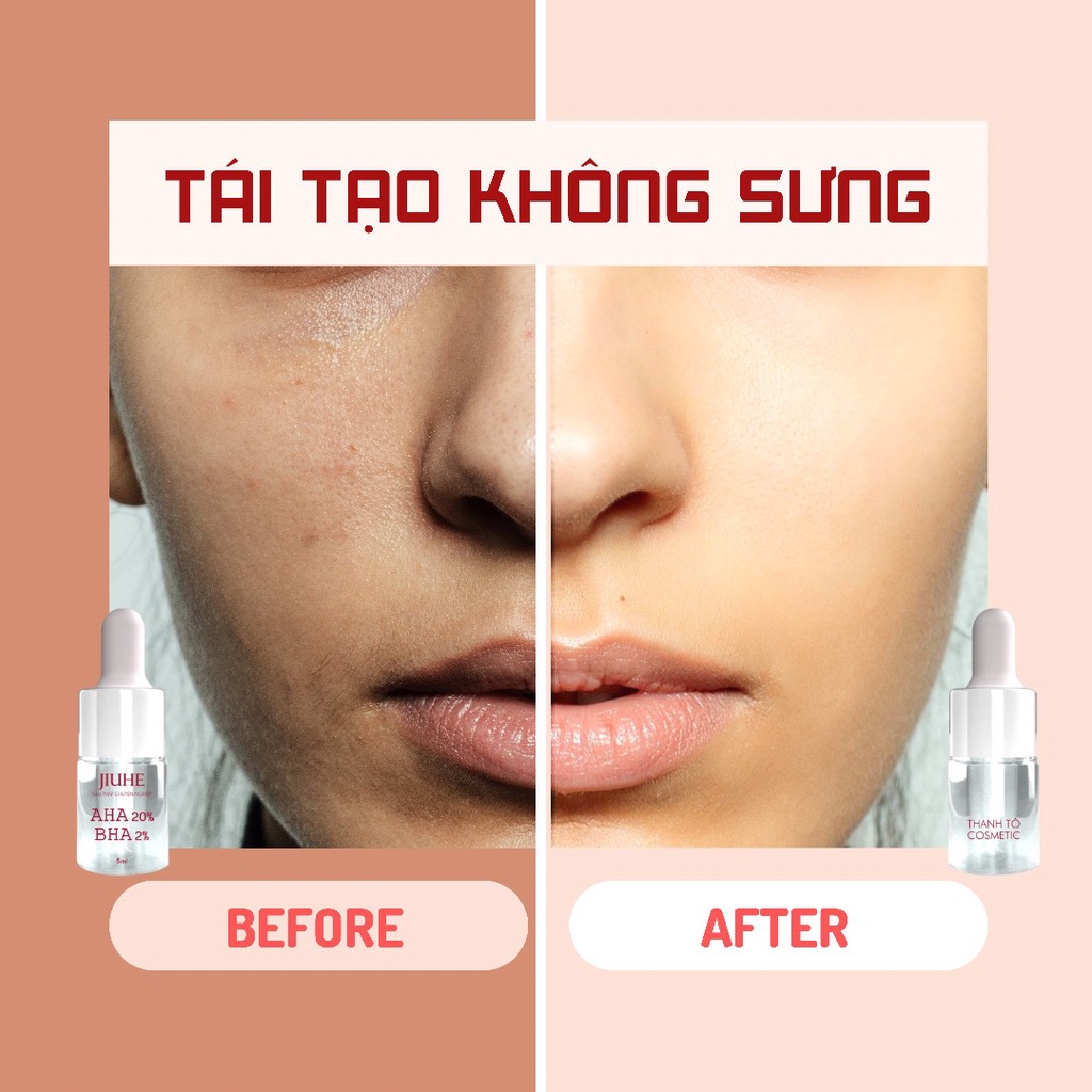 Combo 3 khô da phục hồi_ Serum peel red jiuhe+ Kem dưỡng da face + Serum TH'A _Combo mỹ pẩm Thanh Tô(CHÍNH HÃNG)