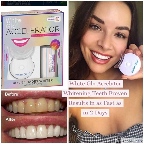 [Hàng chuẩn Úc] Bộ làm trắng răng bằng ánh sáng xanh White glo white accelerator blue light teeth whitening system Úc