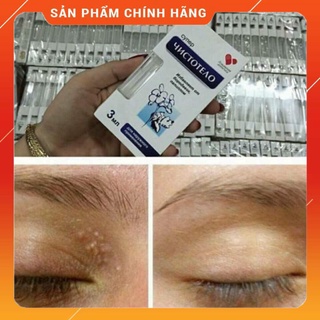 Tẩy Mụn Ruồi Nga
