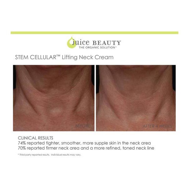 Juice Beauty - Kem dưỡng ẩm nâng cơ, trẻ hóa da cổ Juice Beauty Stem Cellular Lifting Neck Cream 50ml