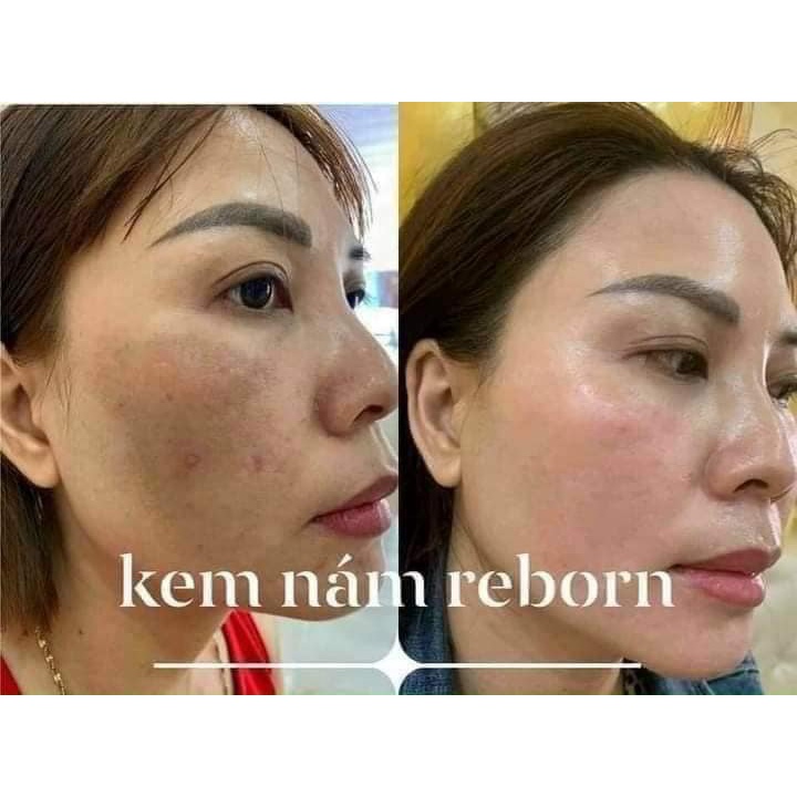 Kem Nám Đêm Reborn Dưỡng Trắng Dành Cho Da Nám
