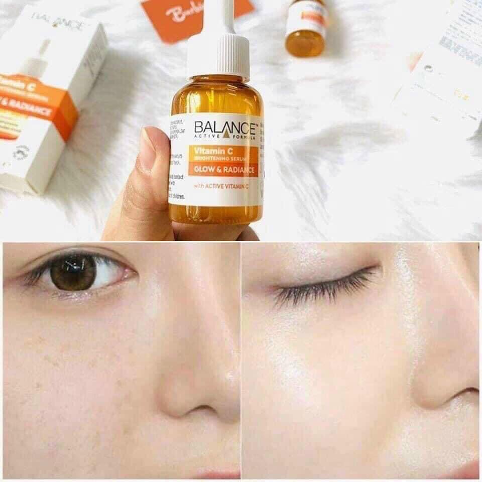 Serum làm mờ thâm và sáng da Balance Vitamin C dung tích 30ml. | BigBuy360 - bigbuy360.vn