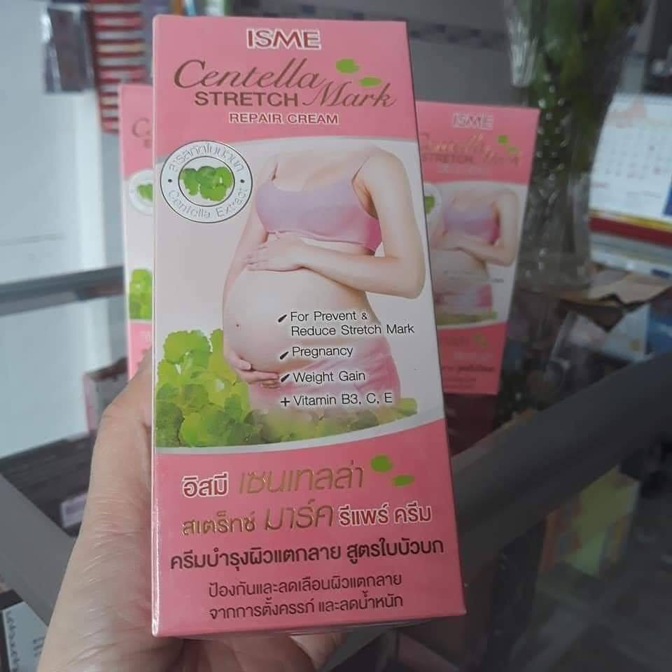 KEM TRỊ RẠN DA ISME CENTELLA STRETCH MARK CHÍNH HÃNG - 3934