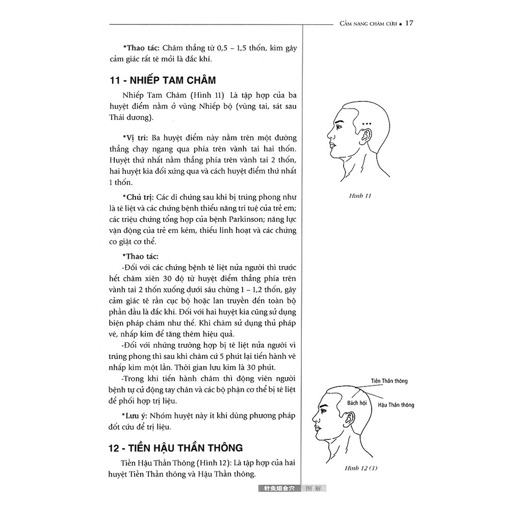 Sách Cẩm Nang Thực Hành Châm Cứu First News
