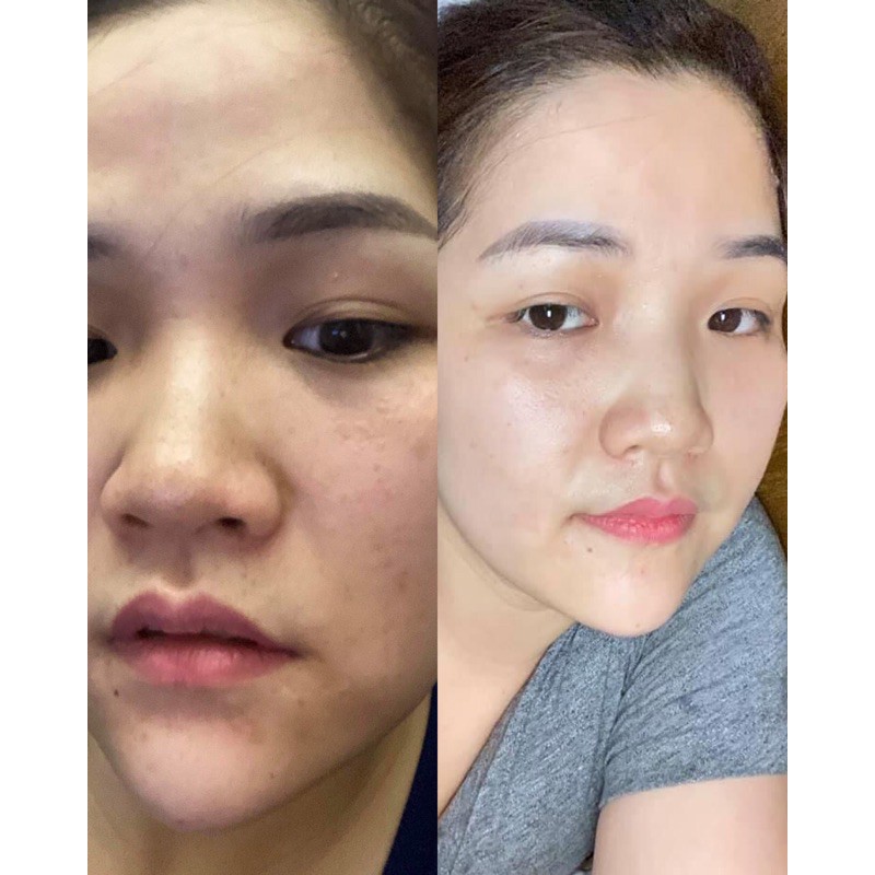 Serum dưỡng trắng mờ thâm nám Black Diamod | BigBuy360 - bigbuy360.vn