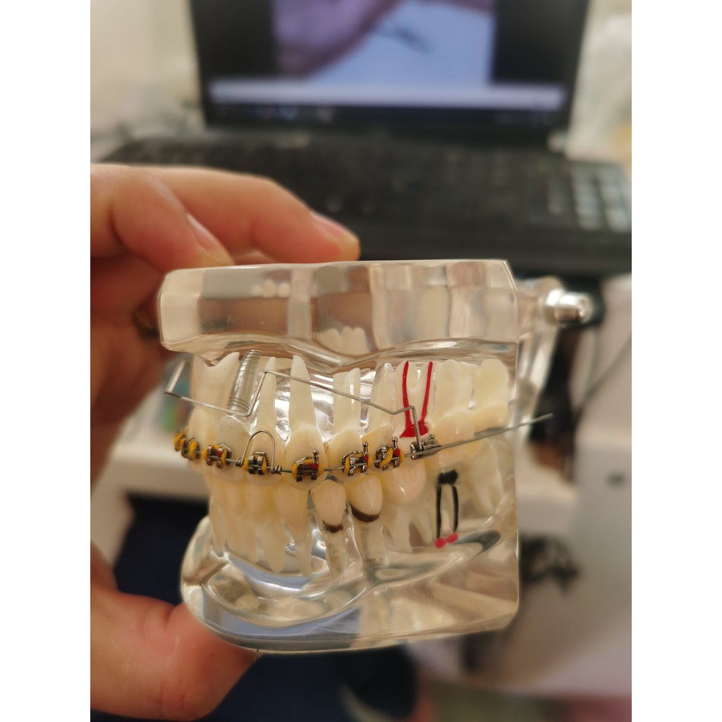 Cung tiện ích chỉnh nha, cung đánh lún ,dây SS mỹ