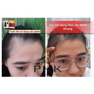 Tinh chất mọc tóc cao cấp Minh Khang