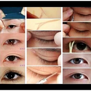 Chỉ tạo mắt 2 mí siêu tự nhiên