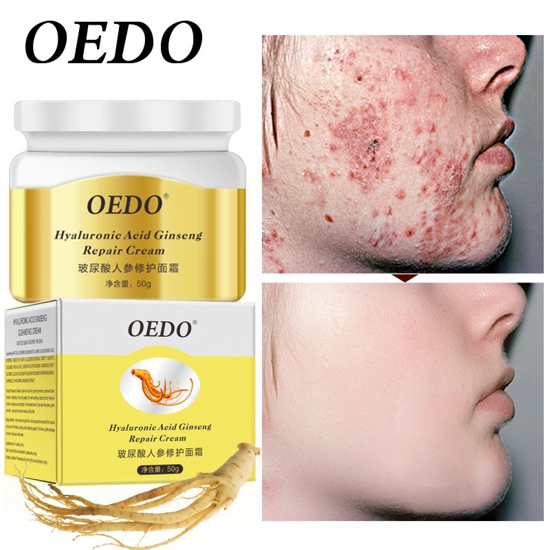 Kem Dưỡng Da Oedo Chiết Xuất Nhân Sâm Hyaluronic Acid Kiềm Dầu Làm Trắng Da Phù Hợp Cho Mọi Loại Da giúp da tươi sáng hồi Chống nhăn 50g