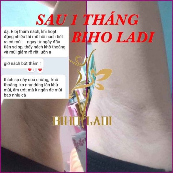 KEM THÂM NÁCH - HÔI NÁCH - BIHO LADI 5S - Siêu Dưỡng Thâm 5s - Đánh Bay Thâm Nách, Thâm Mông, Thâm Bikini, BIHO LADY