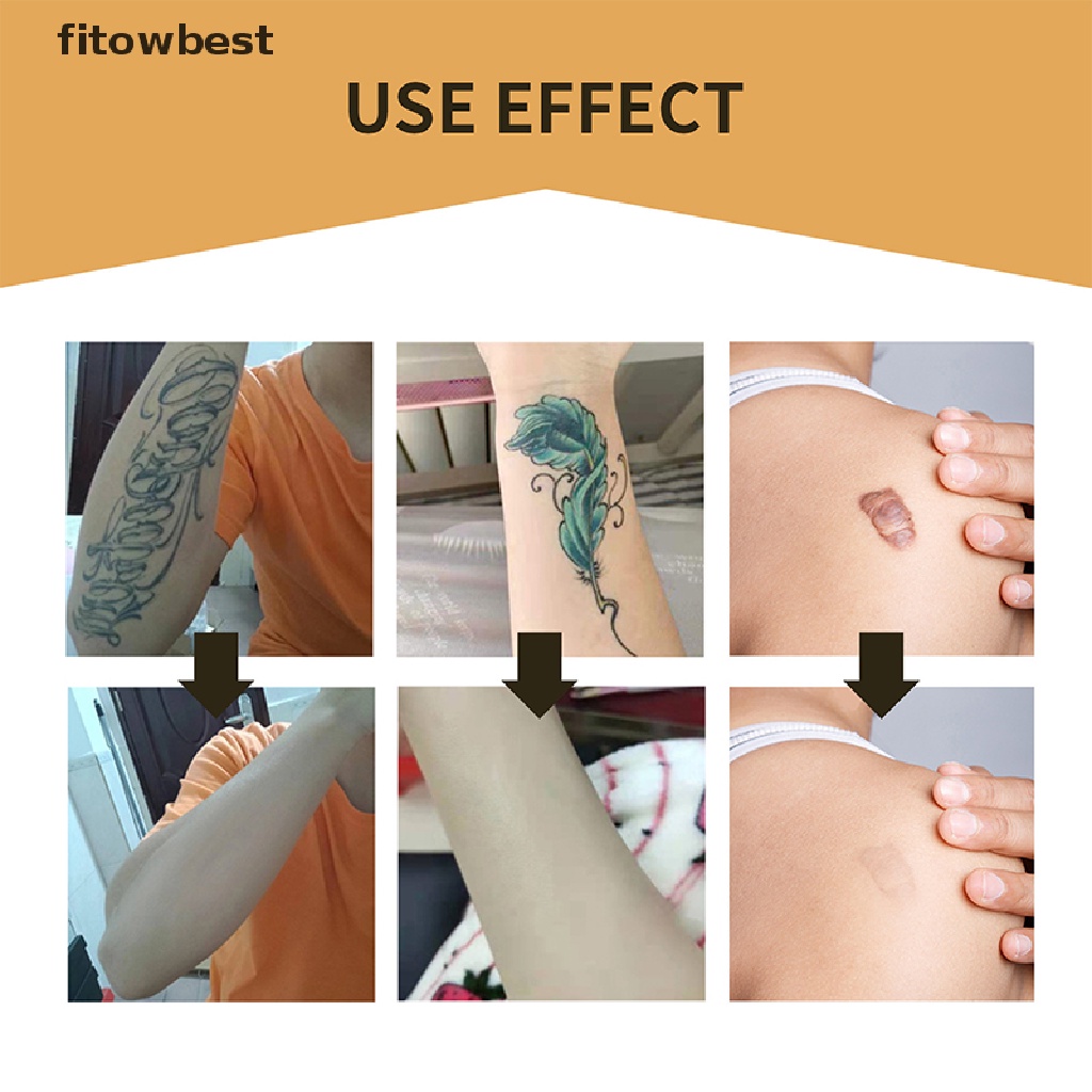 Ftvn Skin Invisible Concealer Patch Sticker Breathable Tattoo Scar Cover Waterproof QDD