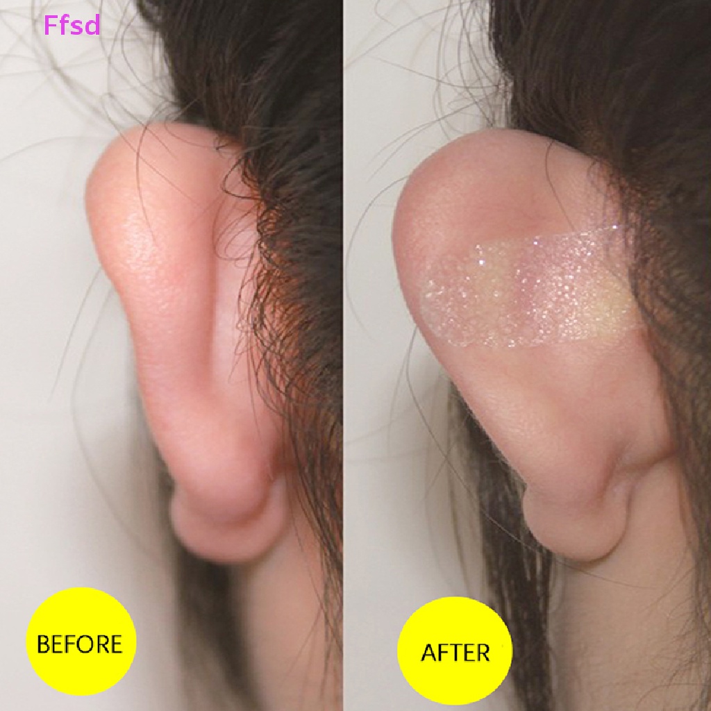 {Ffsd} Miếng Dán Chỉnh Sửa Tai Elf Hình Chữ V * Hàng Bán Chạy