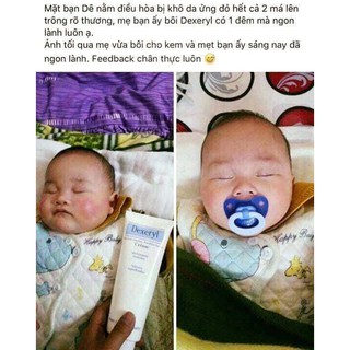KEM DƯỠNG DA DEXERYL TRỊ NẺ CHÀM