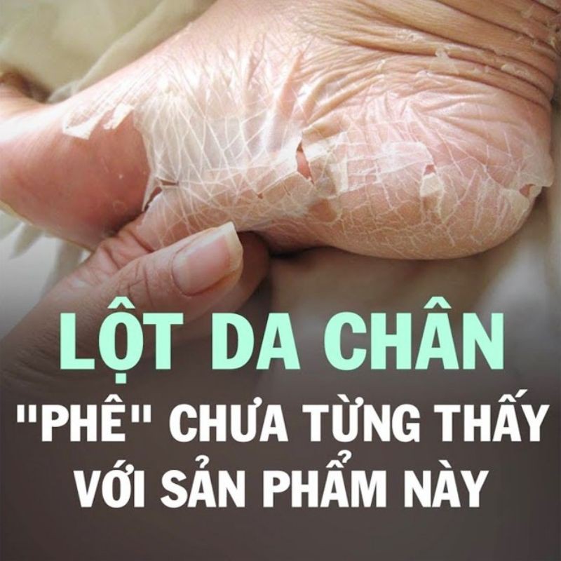 Ủ Lột Trắng Da Chân Sau 3 tiếng