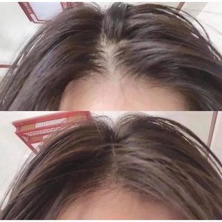 Huyết thanh kích mọc tóc Sato 30ml