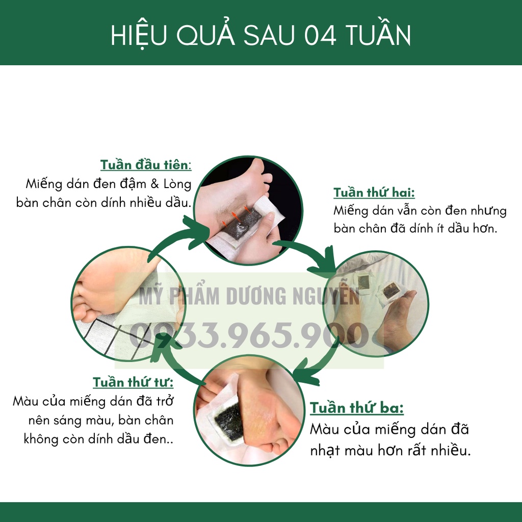 Miếng Dán Ngải Cứu Thải Độc Chân Lão Bắc Kinh 50 Miếng/Hộp