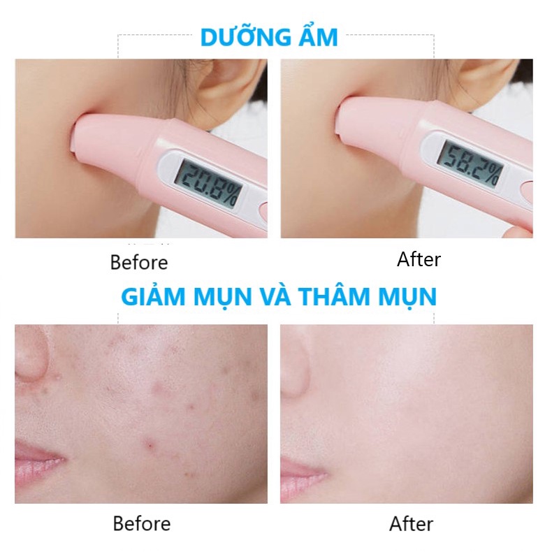 Mặt Nạ RUOFU Hoa Cúc Dưỡng Ẩm Ngừa Mụn Giảm Thâm Làm Dịu Da Nội Địa Trung 28ml