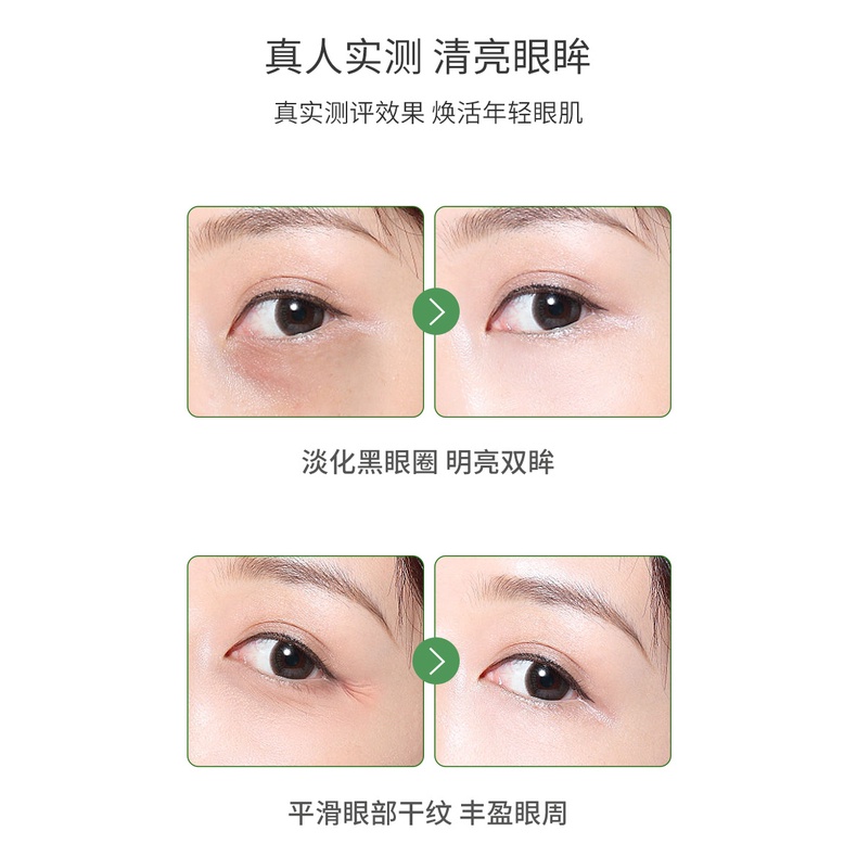 Kem dưỡng da mắt chiết xuất từ bơ loại bỏ quầng thâm làm mờ vết chân chim dưỡng ẩm cho da săn chắc