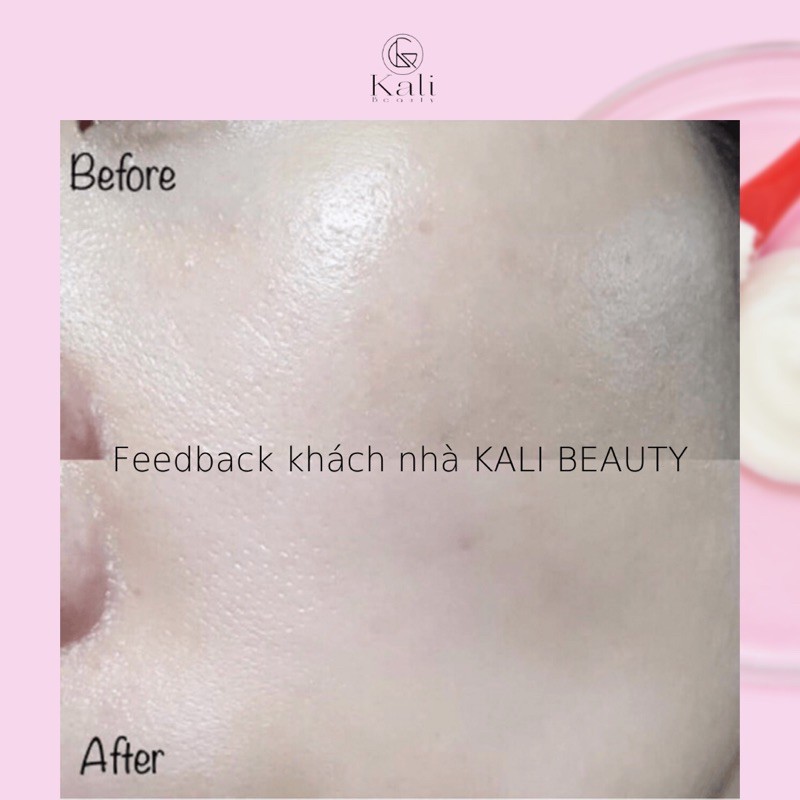 MẶT NẠ THẠCH CELDERMA COLLAGEN KOREA (Hộp 4miếng)