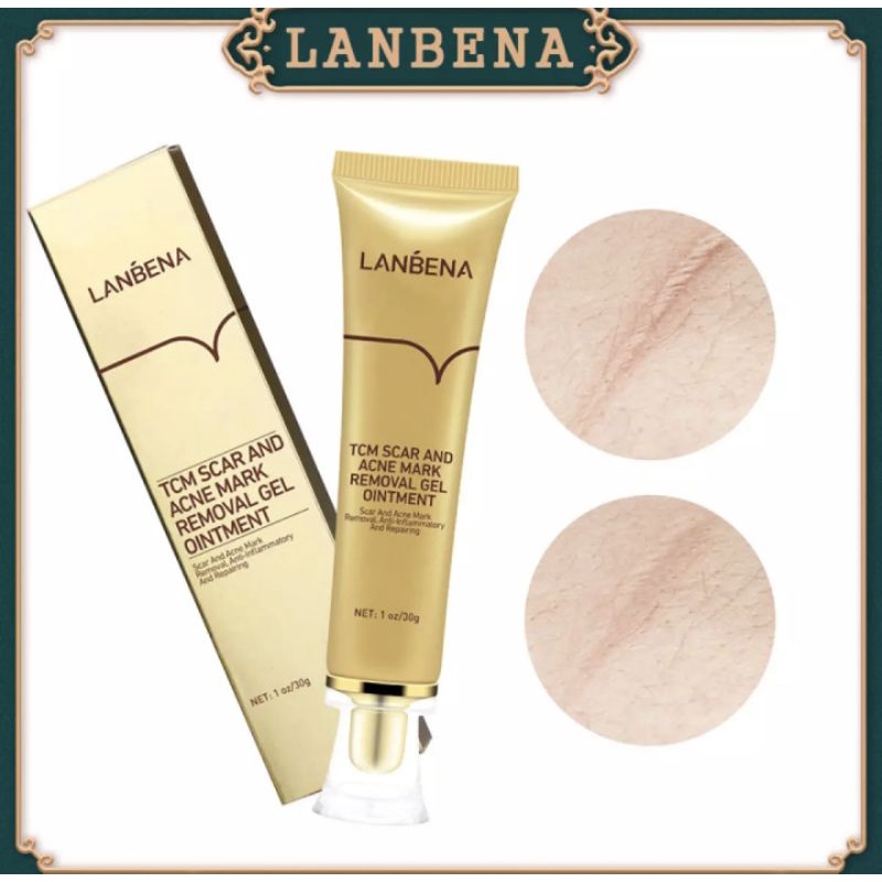 LANBENA KEM LÀM MỜ SẸO MỤN VÀ RẠN DA SAU SINH CHĂM SÓC SẸO THÂM TCM SCAR GEL ACNE SCAR STRETCH MARK//T3