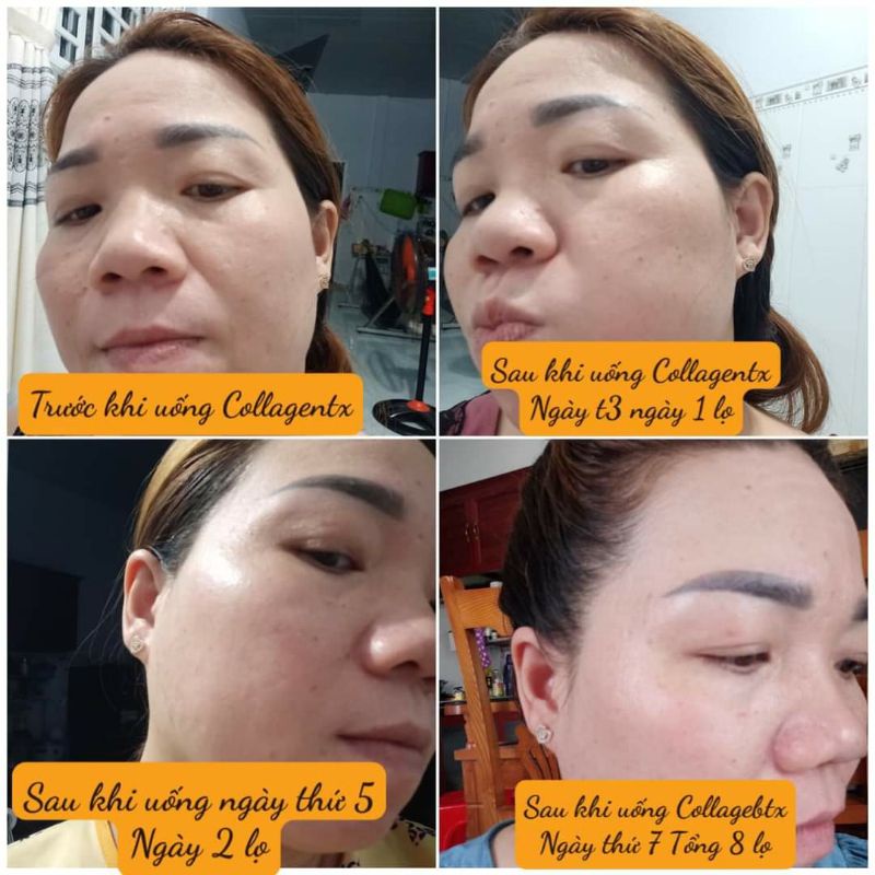 Colagen tế bào gốc tặng mặt nạ đẹp da