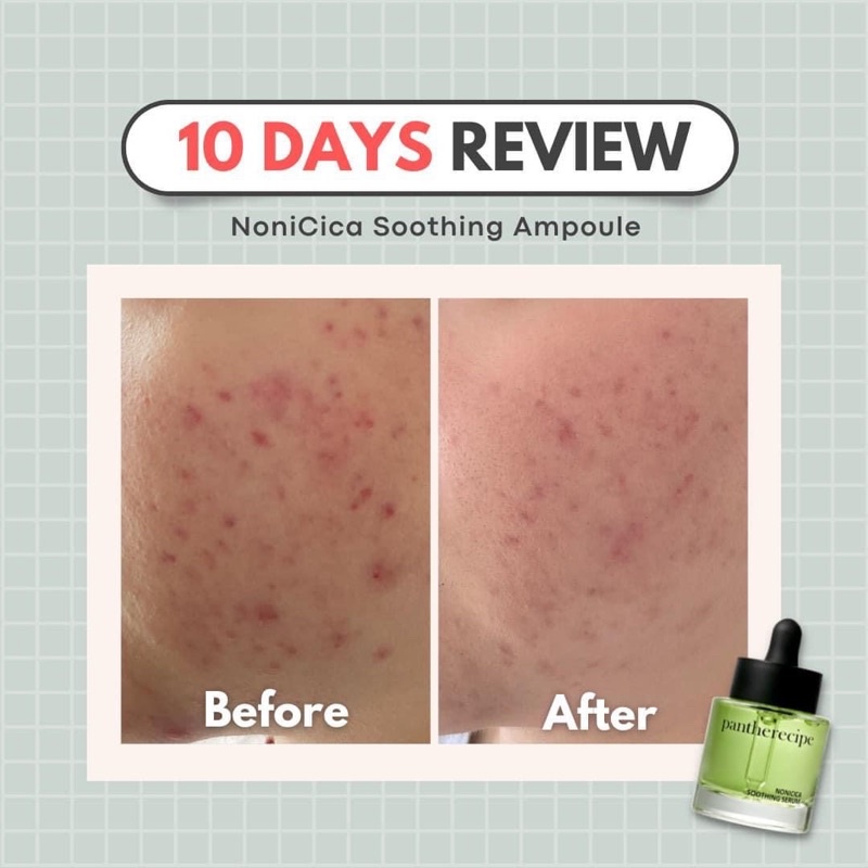Tinh chất PESTLO Pantherecipe Nonicica Soothing Serum 30ml