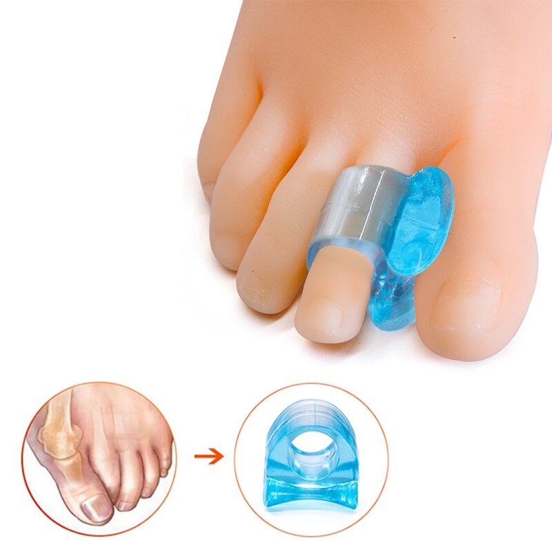 [Hàng mới về] Set 2 dụng cụ tách ngón chân chỉnh hình bằng silicon mềm màu xanh dương chống tật vẹo ngón chân cái
