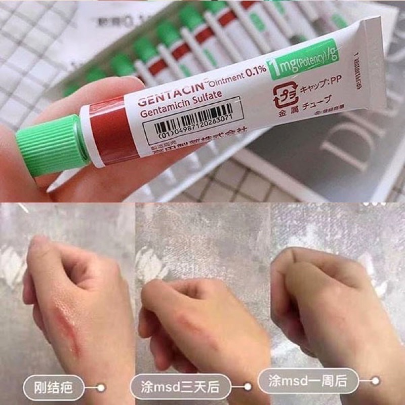 Gel bôi làm mờ sẹo, giảm thâm hiệu quả Gentacin tuýp 10g Hàng Nội Địa Nhật