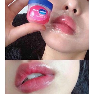 DƯỠNG MÔI VASELINE 7G DẠNG HŨ