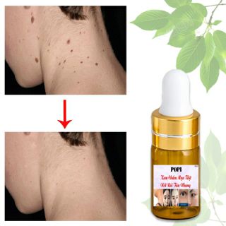 KEM XÓA MỤN THỊT NỐT RÙI TÀN NHANG