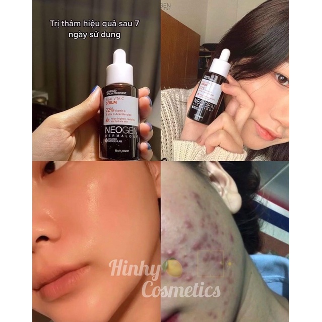 Serum Vitamin C 22% NEOGEN Tinh Chất NEOGEN DERMALOGY REAL VITA C SERUM