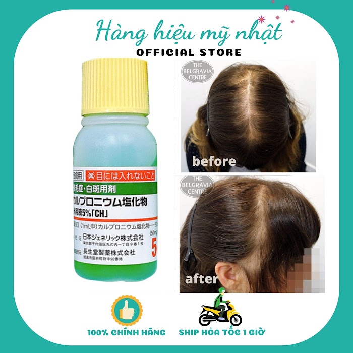 Mọc tóc thảo dược Sato Nhật bản – 30ml