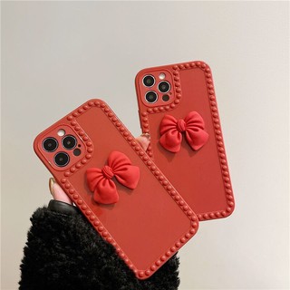 Ốp lưng iphone gắn nơ 6plus 7plus, 8plus, x, xs max, 11, 11pro max bảo vệ camera