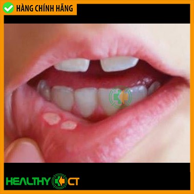 ✅CHÍNH HÃNG - CHẤM RĂNG EUPOLIN - 12 HVQY giúp cải thiện vấn đề răng miệng hiệu quả