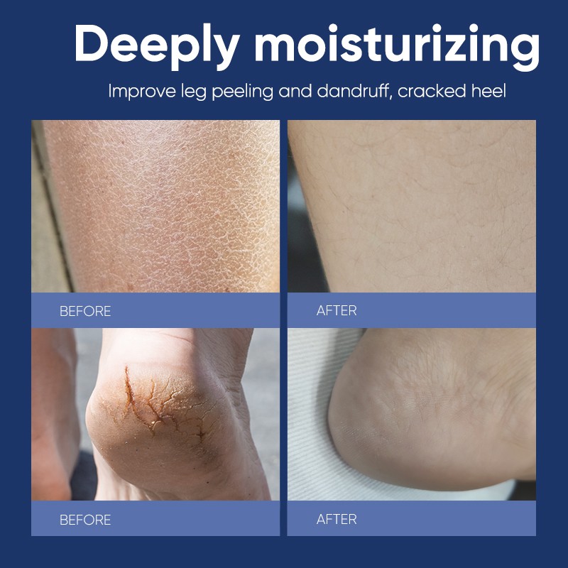 Kem dưỡng ẩm YAMALISA Vaseline Extra Runtime 45g | BigBuy360 - bigbuy360.vn