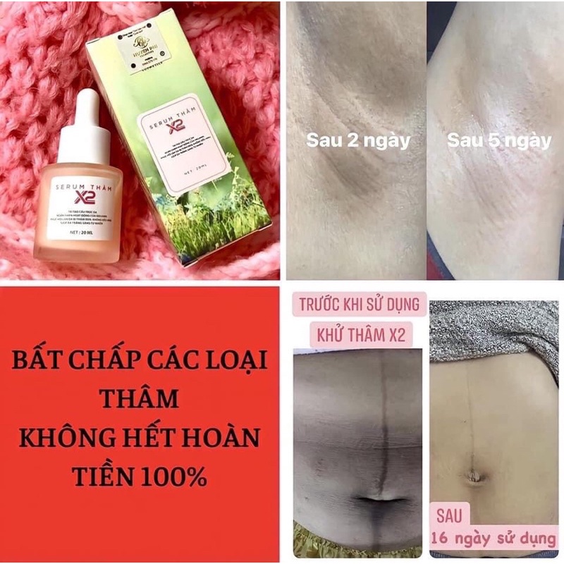 Serum Khử Thâm Nách Vùng Kín Bikini Chân Tay Body X2 Huyền Phi KLKTHP03 Dưỡng Trắng Hồng Vùng Nách Bikini Chân Tay Body